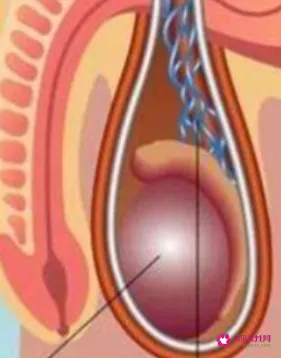 拉扯阴囊能增强性功能吗