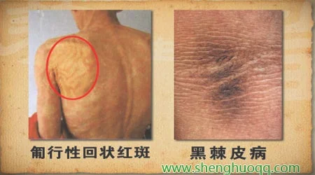皮肤瘙痒与内脏疾病的关系,润泽皮肤的方法